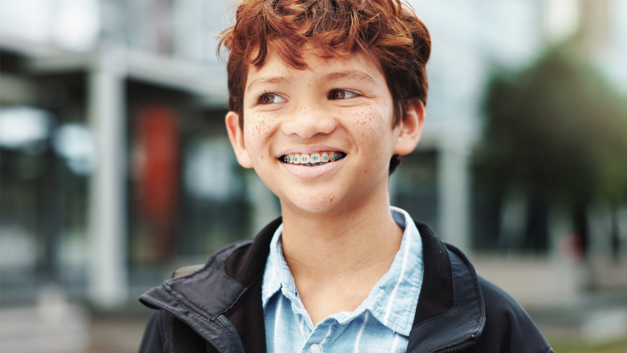 A young red-haired boy smiles and shows his braces – information about braces cost.